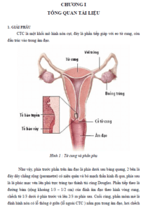 cham soc benh nhan xa tri va phau thuat ung thu co tu cung