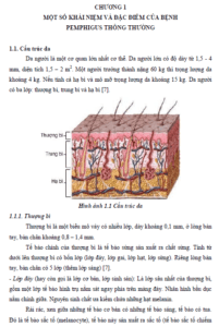 cham soc nguoi benh mac benh pemphigus thong thuong 1
