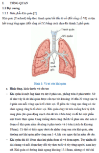 danh gia ket qua cham soc ho hap va muc do kho tho cua benh nhan sau cat noi khi quan tan tan tai benh vien trung uong quan doi 108